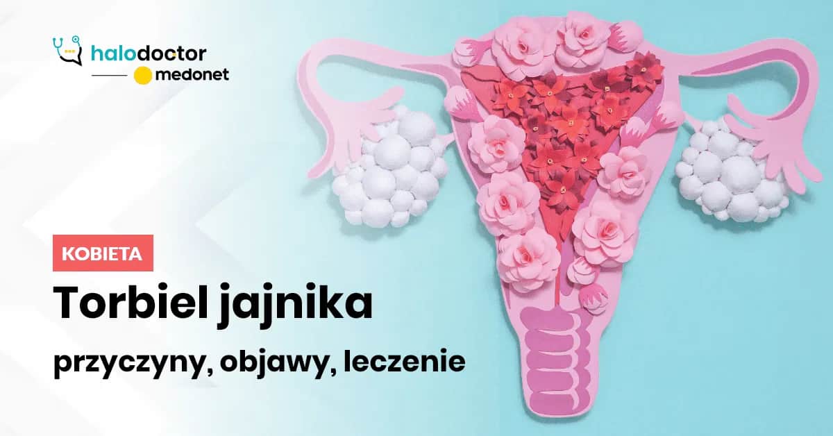 Jakie leki na torbiel jajnika? Skuteczne opcje leczenia i objawy
