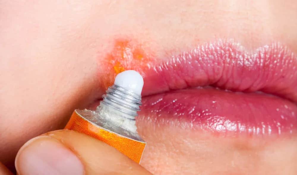 Skuteczne leki na opryszczkę - co wybrać, aby szybko wyleczyć?